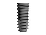 Implants