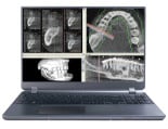 Treatment Planning Software